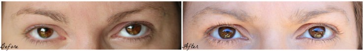 Get Beautiful Lashes and Brows with RapidLash