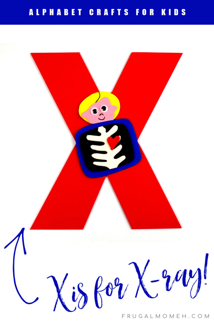 This week in my series of ABCs kids crafts featuring the Alphabet, we are doing a X is for X-Ray craft. These Alphabet Crafts For Kids are a fun way to introduce your child to the alphabet.