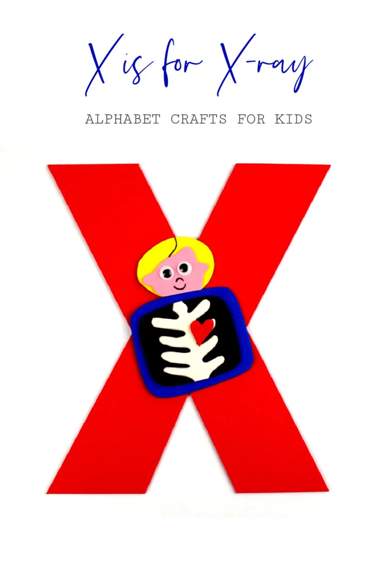 This week in my series of ABCs kids crafts featuring the Alphabet, we are doing a X is for X-Ray craft. These Alphabet Crafts For Kids are a fun way to introduce your child to the alphabet.